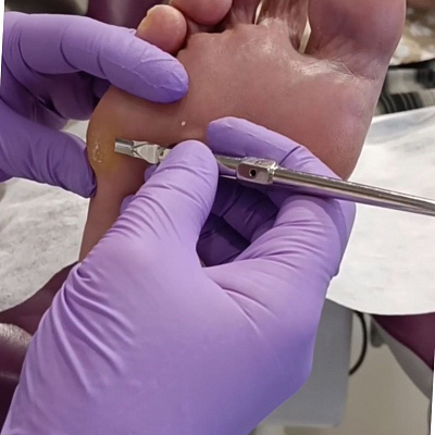 Курс-практикуме «Скальпель»