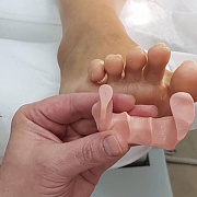 Курс «Стопа и тело: морфофункциональные взаимосвязи. Возможности коррекции стопы ортозами»