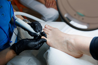 Особенности работы с диабетической стопой. Интеграция рекомендаций медицинских в практику мастера аппаратного педикюра