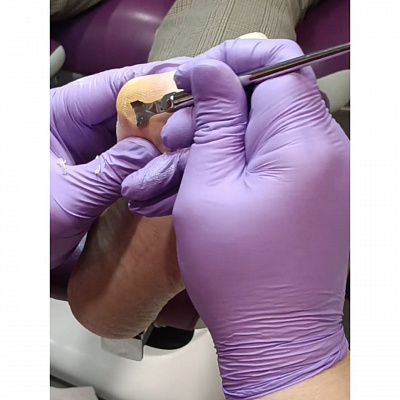 Скальпельные техники