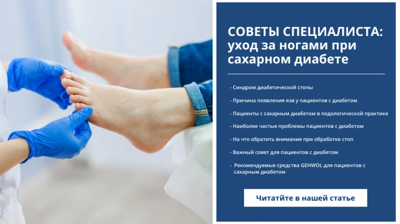 Советы от специалиста: уход за ногами при сахарном диабете